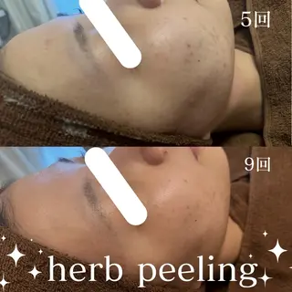 美肌salon GRAN CUORE所属・Natsuki🌙 GRAN CUOREのエステ・リラクイメージ