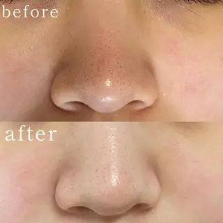 毛穴専門サロン　フルール所属・フルールFululu 自由が丘のエステ・リラクイメージ