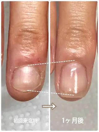 ネイル プライベートネイルサロンPause(ポーズ)所属・自爪育成ネイルサロン Pause(ポーズ)のネイルデザイン