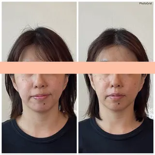 小顔矯正サロン　ReFace Fusae（リフェイスフサエ）所属・小顔矯正サロン リフェイスフサエのエステ・リラクイメージ