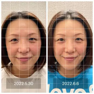 美容鍼　蒼月-aotsuki-所属・美容鍼「蒼月」 -アオツキ-のエステ・リラクイメージ