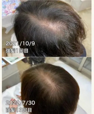 NONOKEKE ノノケケのエステ・リラクイメージ