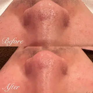 シミ🩷ニキビ専門店 Matteo🎀✨のエステ・リラクイメージ