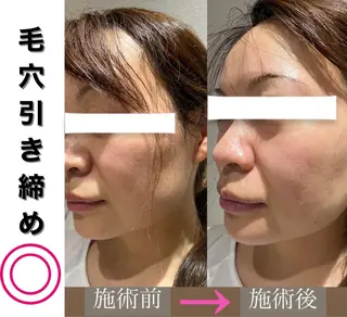 脱毛&美容サロンBLUESEA所属・脱毛&美容サロン BLUESEAのエステ・リラクイメージ