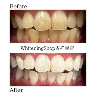 ホワイトニング ショップ吉祥寺店のエステ・リラクイメージ