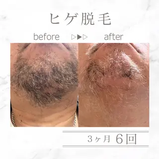 メンズ エステサロンNarcis〜ナルシス〜所属・脱毛＆痩身エステ Narcisのエステ・リラクイメージ