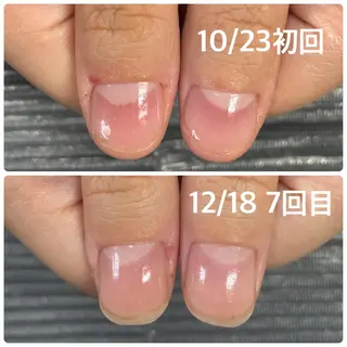 ネイル 奥園 良恵のネイルデザイン