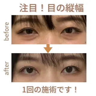 小顔サロン AMYONのエステ・リラクイメージ