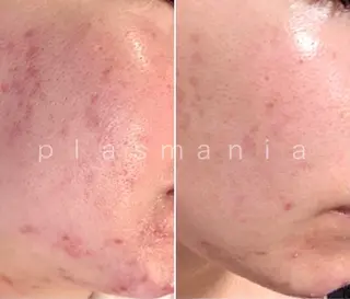 private salon éclat所属・ニキビ・毛穴専門 éclat/エクラのエステ・リラクイメージ