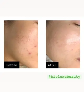 BIOLUXE BEAUTY所属・バイオラックス ビューティーのエステ・リラクイメージ