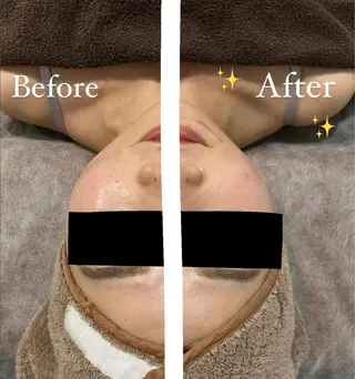 脱毛サロン fam.豊澤柚良のエステ・リラクイメージ