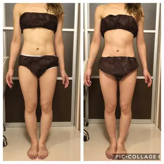 セミロング カラー パーマ メンズ キッズ ネイル マツエク・マツパ アニメ,Vオタク× 即効痩せエステサロンのエステ・リラクイメージ