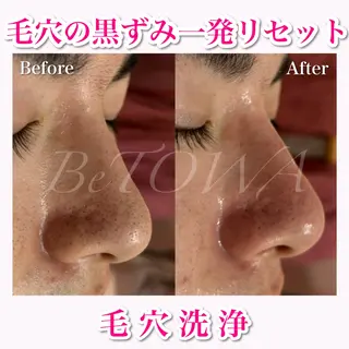 BeTOWA所属・BeTOWA 毛穴洗浄/Wax脱毛のエステ・リラクイメージ