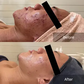 Luana ∞のエステ・リラクイメージ