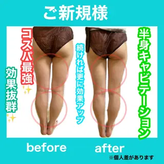 痩身/脱毛/ネイル HARUKAのエステ・リラクイメージ