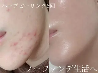 艶肌デトックス🫧 Samiraのエステ・リラクイメージ