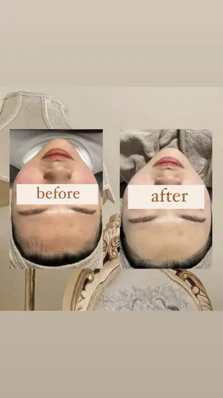 crescent所属・【韓国肌管理・脱毛】 クレセントのその他イメージ