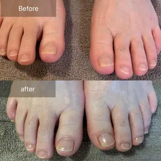 ネイル 木村 千晴のネイルデザイン