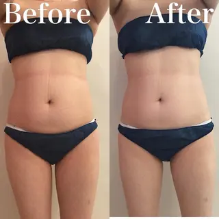 茅ヶ崎Queen エステ/脱毛/リラクのエステ・リラクイメージ