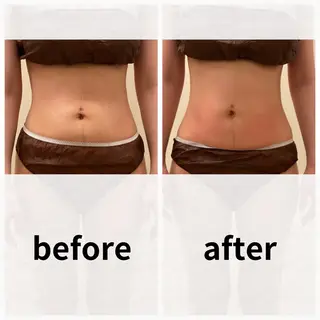 美容鍼/ヘッドスパ/ 💎さかもとのエステ・リラクイメージ