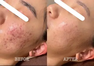 Lys Blancのエステ・リラクイメージ