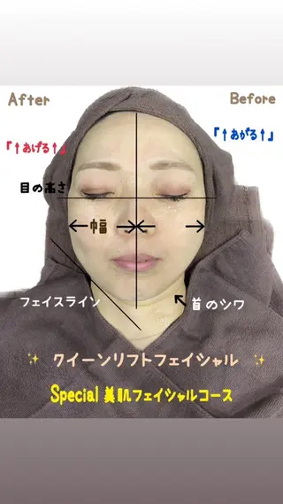 ヴィーナス ビューティーのエステ・リラクイメージ