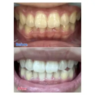 MBEAUTYSALON 千葉店・京成大久保所属・Melty 輝のその他イメージ