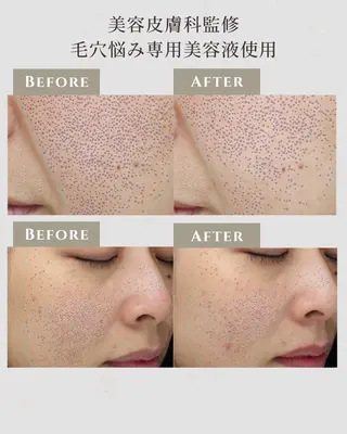 シミ毛穴|眉Wax THE  flowのエステ・リラクイメージ