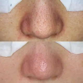 石黒 恵梨香のエステ・リラクイメージ