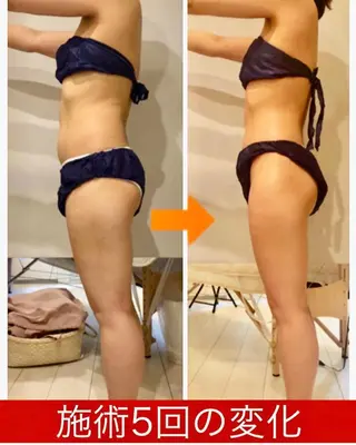 ショート カラー パーマ ヘアアレンジ メンズ キッズ ネイル マツエク・マツパ ‍痩身＆ボディ 結果出し🌟丹野のエステ・リラクイメージ