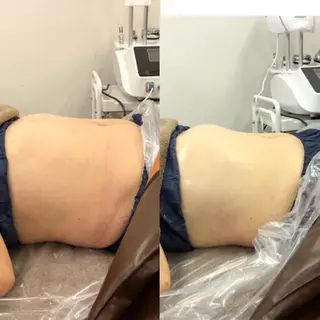 ベルデ106 verde106のエステ・リラクイメージ