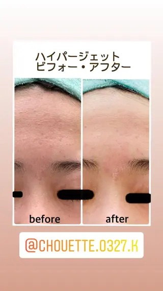 CHOUETTE所属・五島 久美子のエステ・リラクイメージ