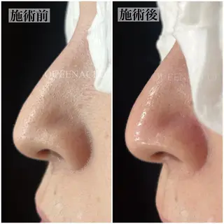 毛穴改善/脱毛 ネイル　川上久仁子のエステ・リラクイメージ