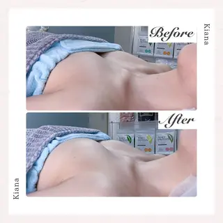 バスト専門Kiana 風のエステ・リラクイメージ