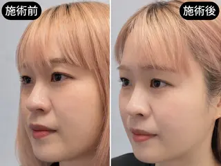 小顔美容鍼専門サロン 渋谷YZのエステ・リラクイメージ