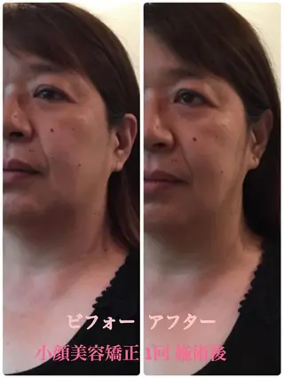 小顔サロン ソ.ルシエのエステ・リラクイメージ