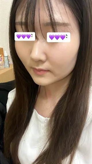 高岡 うさのエステ・リラクイメージ