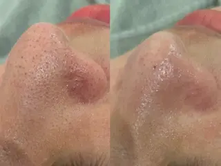 PERSONAL BEAUTY🪻のエステ・リラクイメージ