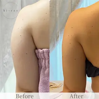 綺麗のひみつ グランプリ受賞店のエステ・リラクイメージ