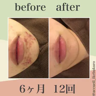 ミディアム カラー パーマ ヘアアレンジ メンズ キッズ ネイル マツエク・マツパ ニキビ・肌質改善専門 ♡人生が変わるサロンのエステ・リラクイメージ