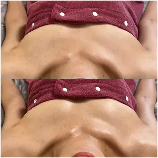 MELIA the beauty所属・肌のお悩み改善サロン MELIA/朋美のエステ・リラクイメージ