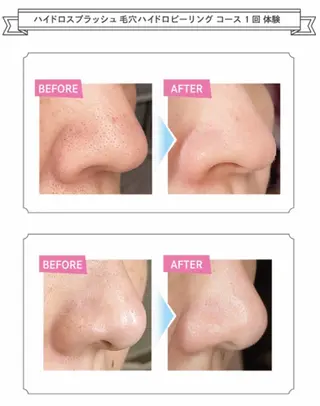 よもぎ蒸し&リラクゼーションサロンcocon所属・今橋 麻希のエステ・リラクイメージ