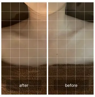 心斎橋痩身ダイエット 韓国.美容鍼.小顔のエステ・リラクイメージ