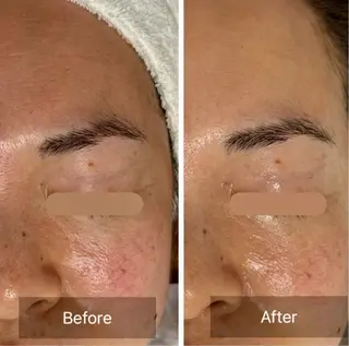 小顔リフト整顔/ 美肌サロンのその他イメージ