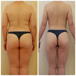 Re:Oasis所属・🦋Re:Oasis 近藤美貴【四谷】🦋のエステ・リラクイメージ