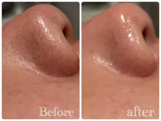 痩身脱毛専門店 Partirのエステ・リラクイメージ