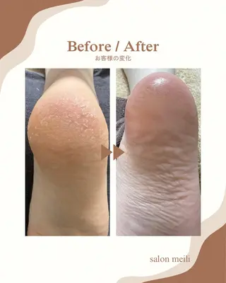 リラク&よもぎ蒸し 耳つぼ♡Mizukiのエステ・リラクイメージ