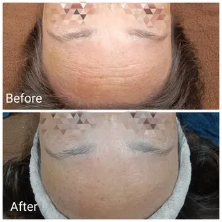 肌質改善Beauty salon Renのエステ・リラクイメージ