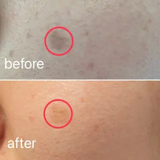 痛くないシミ取り 【荻窪】石橋のヘアスタイル