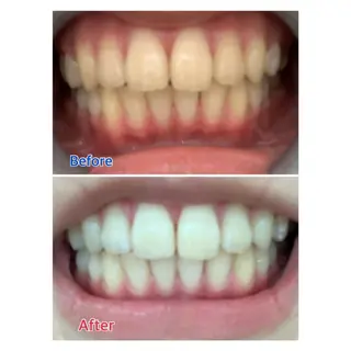 MBEAUTYSALON 千葉店・京成大久保所属・Melty 輝のその他イメージ